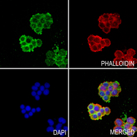 3 - Anti-SFTPA1 Antibody AP53834
