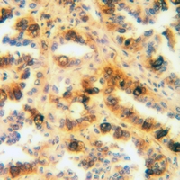 19 - Anti-SFTPA1 Antibody AP53834