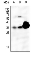 1 - Anti-SFTPA1 Antibody AP53834
