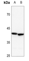 1 - Anti-YKL-40 Antibody AP53837
