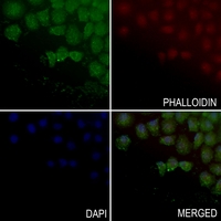 3 - Anti-ABHD4 Antibody AP53839