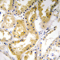 19 - Anti-ABHD4 Antibody AP53839