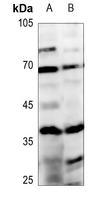 1 - Anti-ABHD4 Antibody AP53839