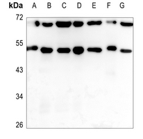 1 - Anti-ADAMDEC1 Antibody AP53840
