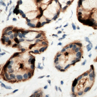 19 - Anti-Adenosine A2b Receptor Antibody AP53841