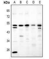 1 - Anti-Adenosine A2b Receptor Antibody AP53841