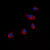3 - Anti-ARRDC4 Antibody AP53842