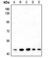 1 - Anti-ARRDC4 Antibody AP53842