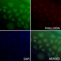 3 - Anti-ATP6V0A2 Antibody AP53844