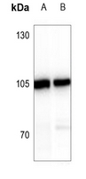 1 - Anti-ATP6V0A2 Antibody AP53844