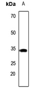 1 - Anti-Carbonic Anhydrase 8 Antibody AP53845