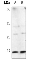 1 - Anti-Procalcitonin Antibody AP53846