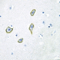 19 - Anti-DGK epsilon Antibody AP53847