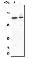 1 - Anti-DGK epsilon Antibody AP53847