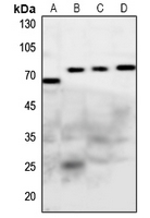 1 - Anti-Frizzled 1/2/7 Antibody AP53848