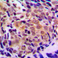 19 - Anti-Histone Deacetylase 5/9 Antibody AP53852