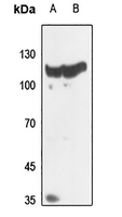 1 - Anti-Histone Deacetylase 5/9 Antibody AP53852