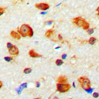19 - Anti-MYO1D Antibody AP53856