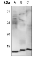 1 - Anti-NDUFB1 Antibody AP53858