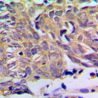 19 - Anti-PXMP2 Antibody AP53862