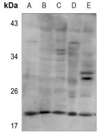 1 - Anti-PXMP2 Antibody AP53862