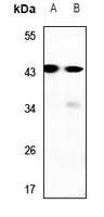 1 - Anti-RAD52B Antibody AP53863