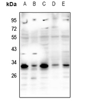 1 - Anti-RNF138 Antibody AP53865
