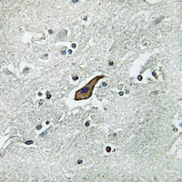 19 - Anti-ROBO2 Antibody AP53866