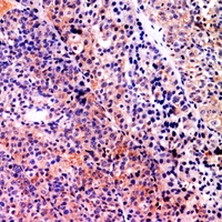 19 - Anti-Serpin B3/4 Antibody AP53869