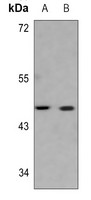 1 - Anti-Serpin B3/4 Antibody AP53869