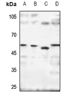 1 - Anti-SH2D4A Antibody AP53870