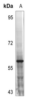 1 - Anti-MST1/2 (Phospho-T183) Antibody AP53874
