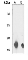 1 - Anti-TCEAL8 Antibody AP53875