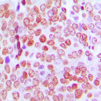19 - Anti-TCF4/12 Antibody AP53876