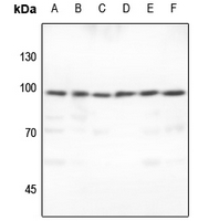 1 - Anti-TCOF1 Antibody AP53877