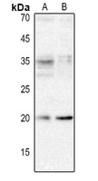 1 - Anti-XCL1 Antibody AP53879