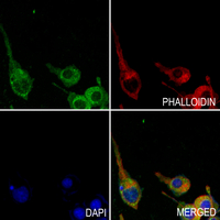 3 - Anti-Filaggrin Antibody AP53883