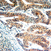 19 - Anti-GBP1 Antibody AP53884
