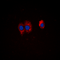 3 - Anti-PI3K p85 alpha/p55 gamma (Phospho-Y467/199) Antibody AP53885
