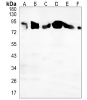 1 - Anti-PI3K p85 alpha/p55 gamma (Phospho-Y467/199) Antibody AP53885