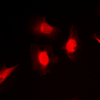3 - Anti-PKC iota/zeta (Phospho-T412/410) Antibody AP53886