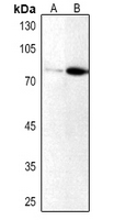 1 - Anti-PKC iota/zeta (Phospho-T412/410) Antibody AP53886