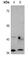 1 - Anti-RagA/B Antibody AP53887