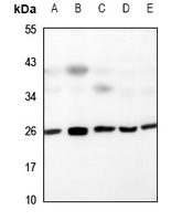 1 - Anti-UBTD2 Antibody AP53888