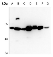 1 - Anti-WWOX Antibody AP53889