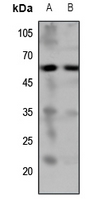 1 - Anti-5-HT7 Antibody AP53890