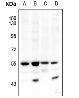 1 - Anti-AKT1/2 (Phospho-T308/309) Antibody AP53891