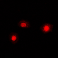 3 - Anti-Cofilin Antibody AP53892