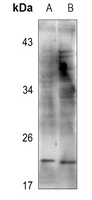 1 - Anti-Cofilin Antibody AP53892