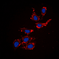 3 - Anti-Collagen 18 alpha 1 Antibody AP53893